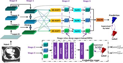 3D IFPN: Improved Feature Pyramid Network for Automatic Segmentation of Gastric Tumor